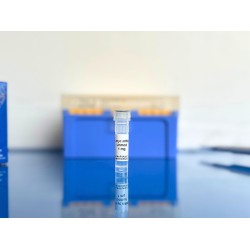 c-Myc mRNA