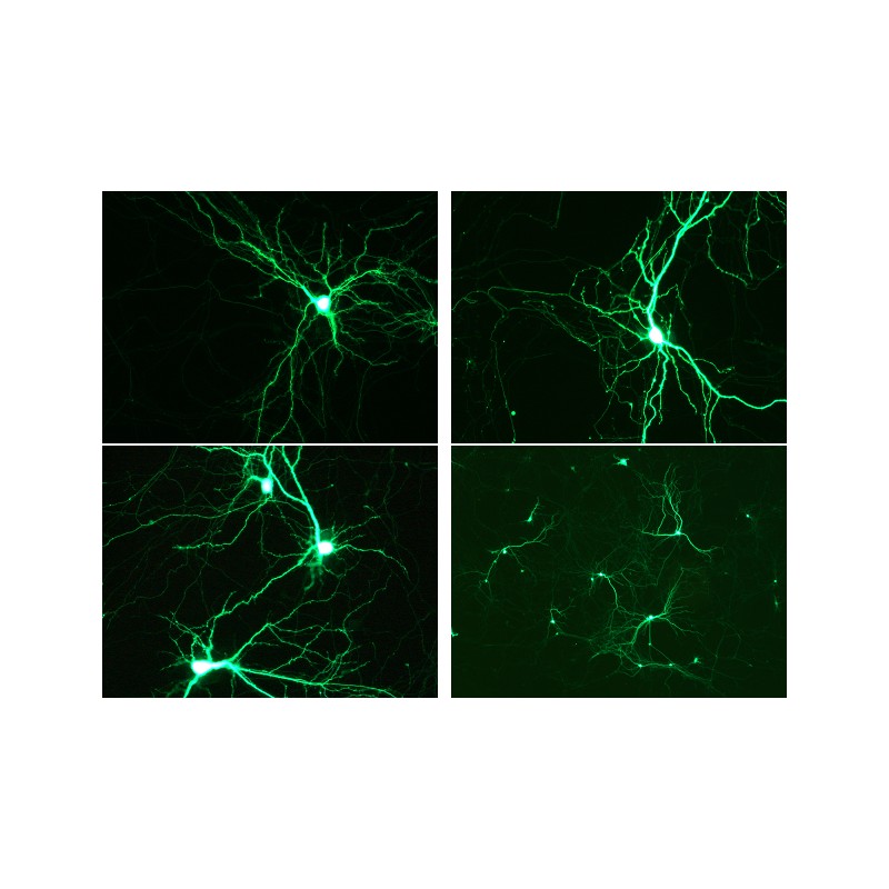 neuron transfection