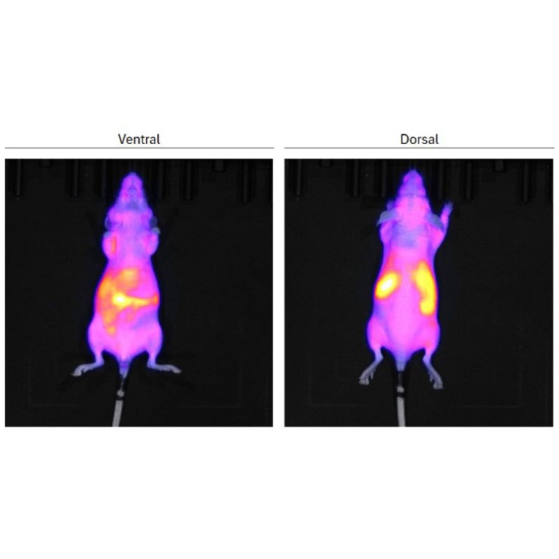 lnp mrna multi organ