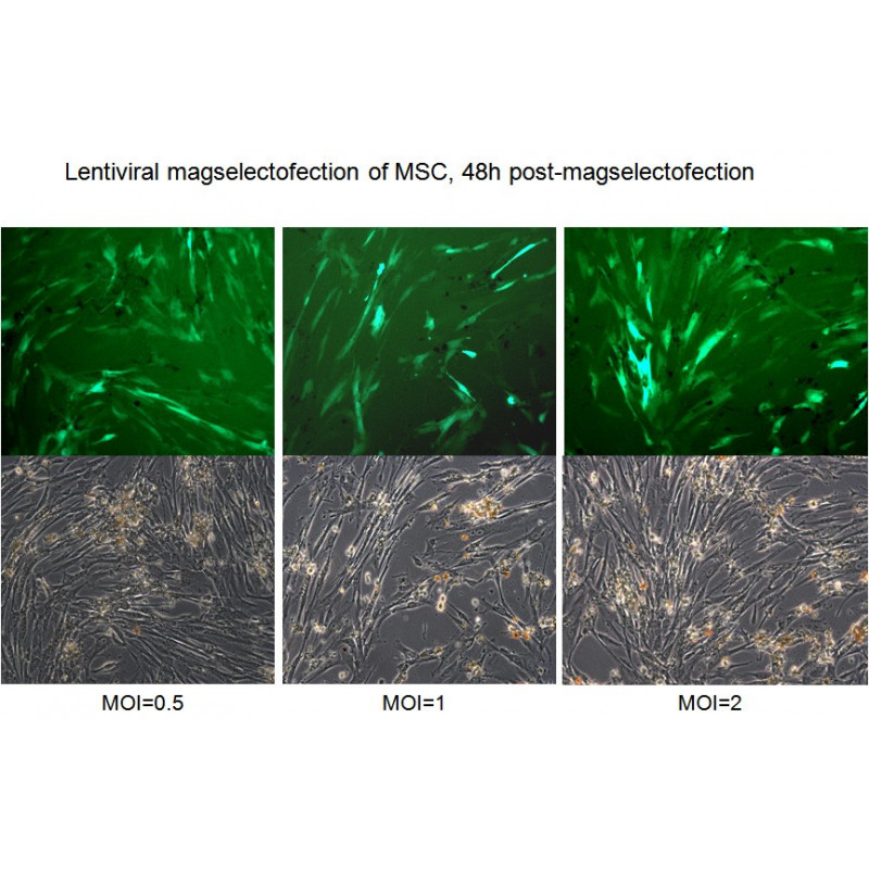 cell sorting column transduction