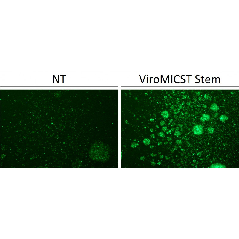 stem cell cell sorting column infection