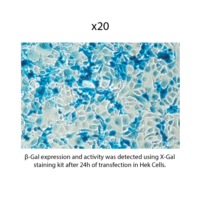 β-Gal mRNA