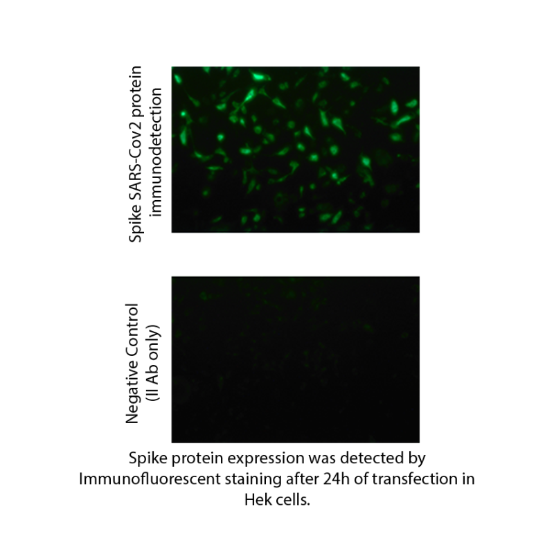 Spike SARS CoV-2 mRNA