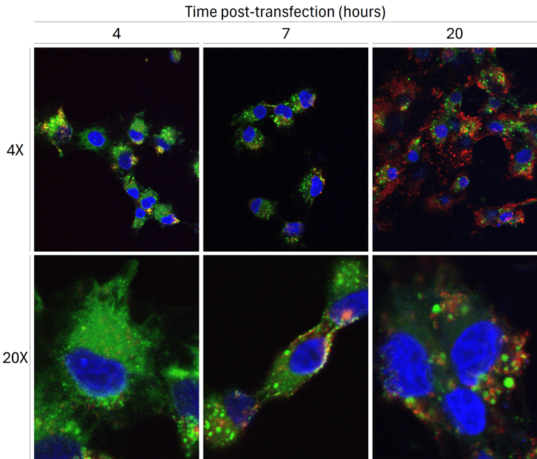 Confocal microscopy showing LNP-siRNA cytoplasmic delivery with Cy5-labeled siRNA and DiO-labeled lipid nanoparticles in MCF7 cells