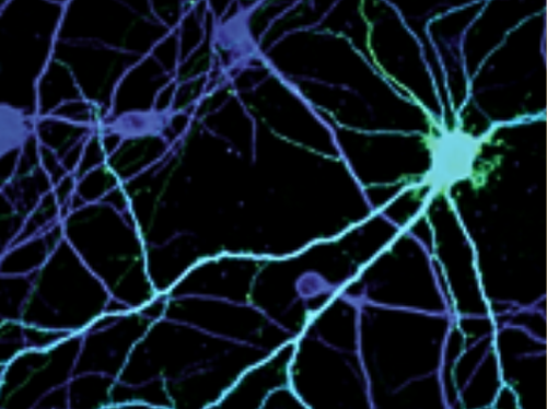 neuronal transfection