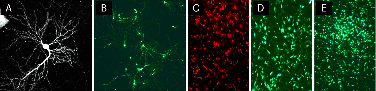 neural cell types transfected with NeuroMag