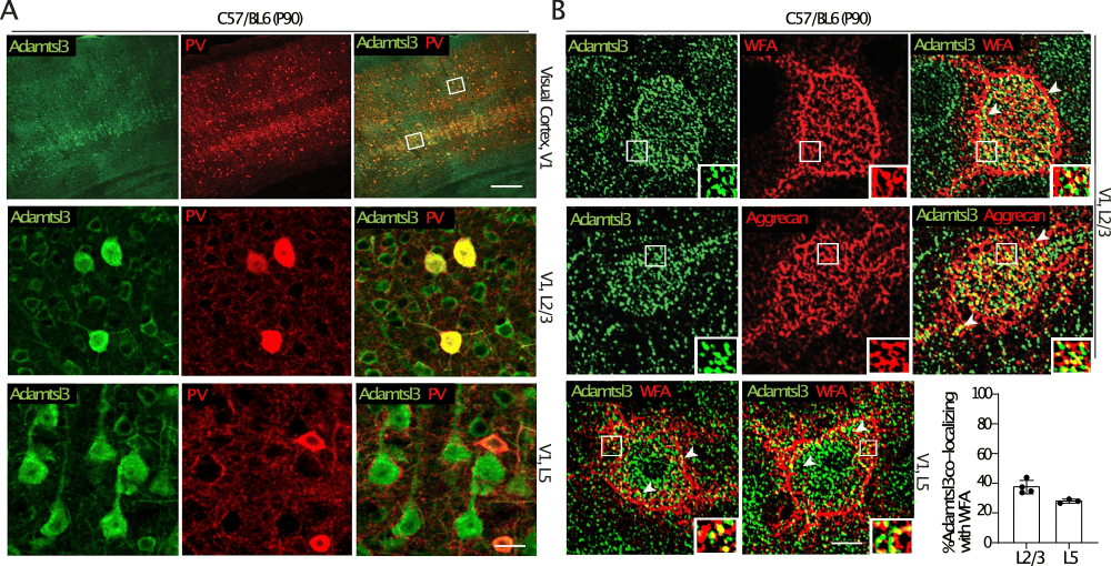 primary rat hippocampal neurons transfection