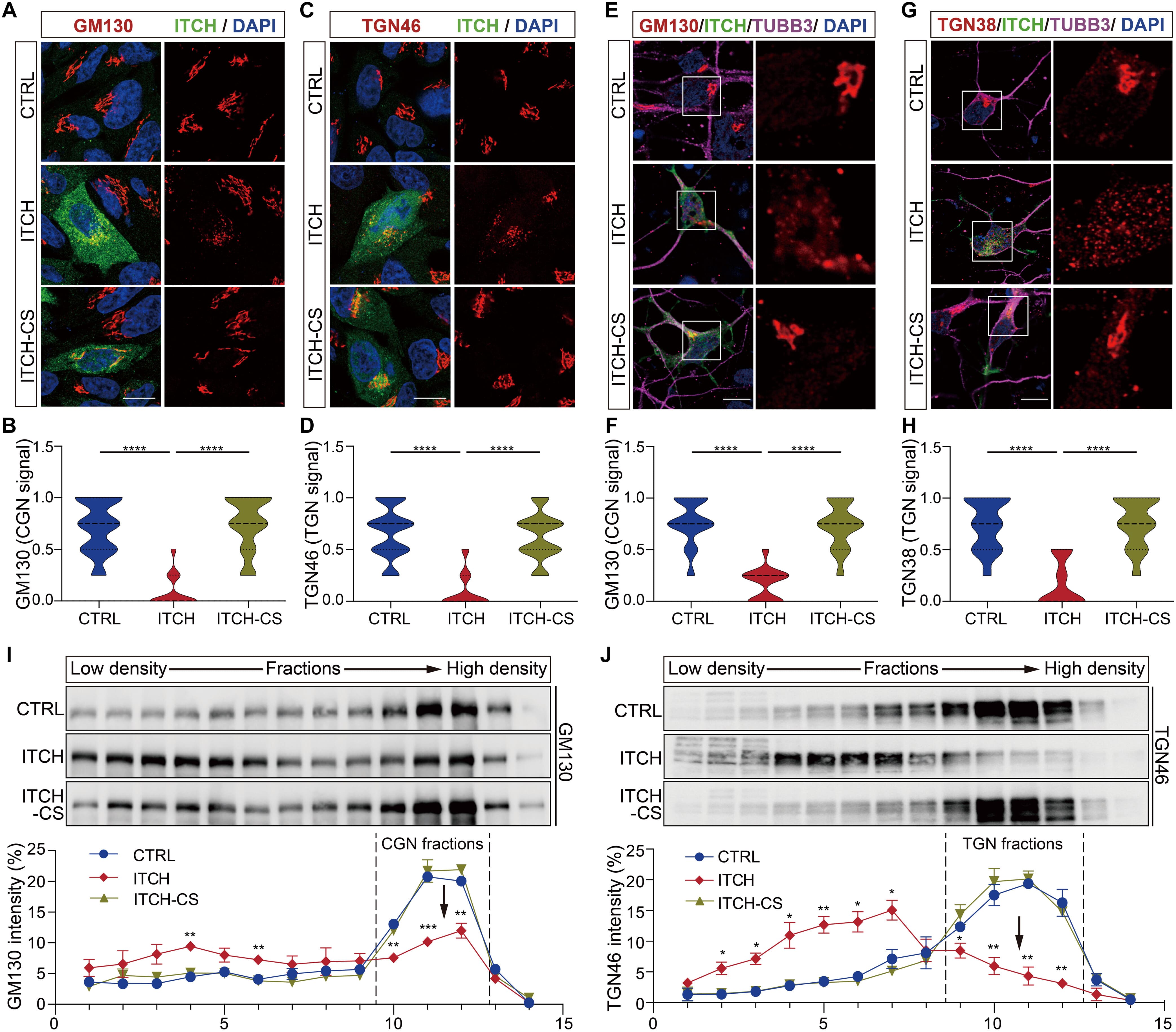 neuronal transfection reagent