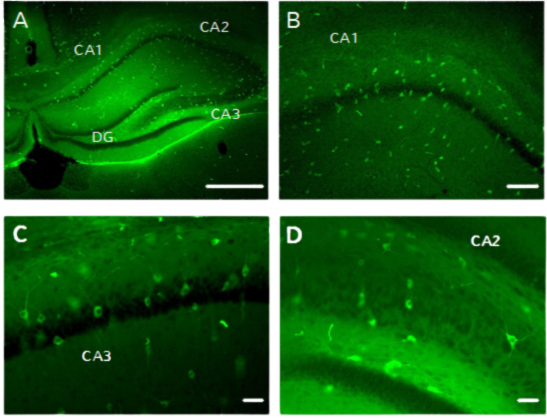 transfection of neural cells