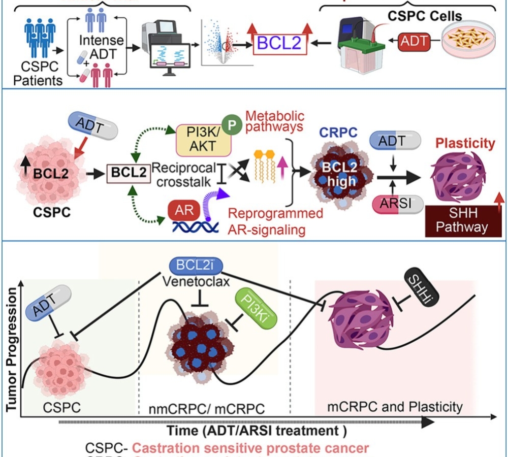 BCL2 drives castration resistance in castration-sensitive prostate cancer