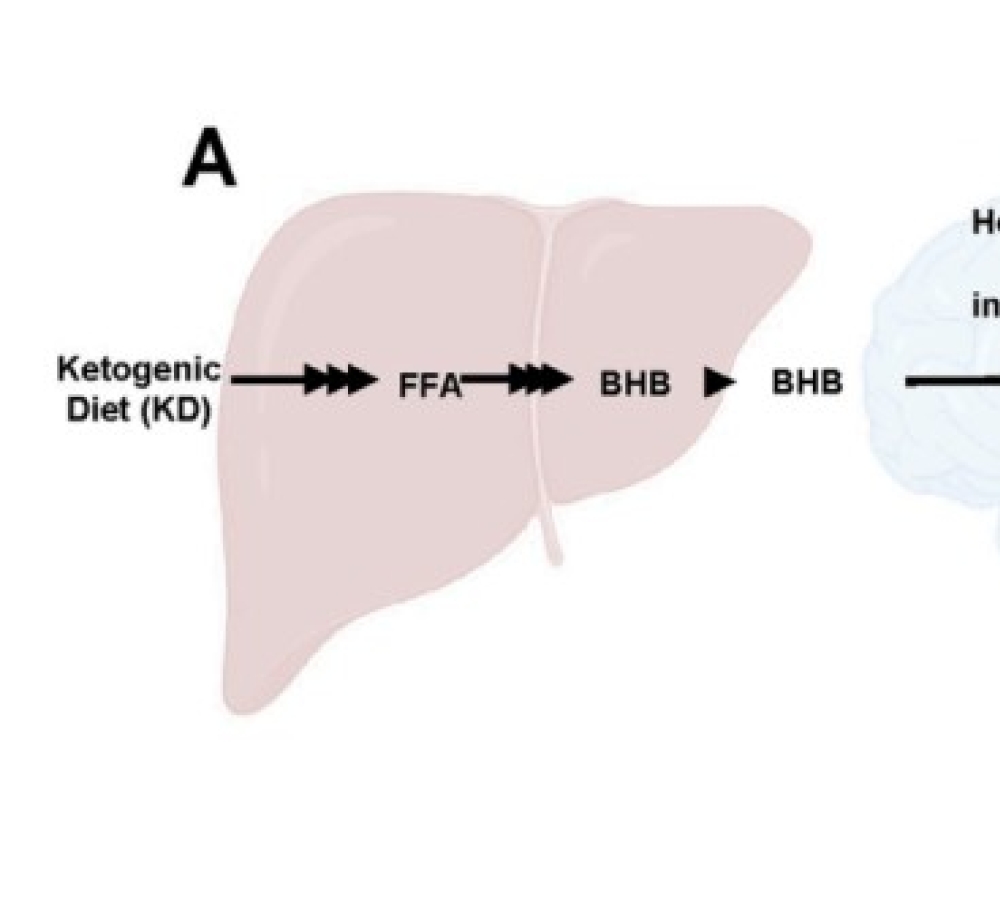 Concentration-dependent anti-inflammatory effects of BHB on microglia