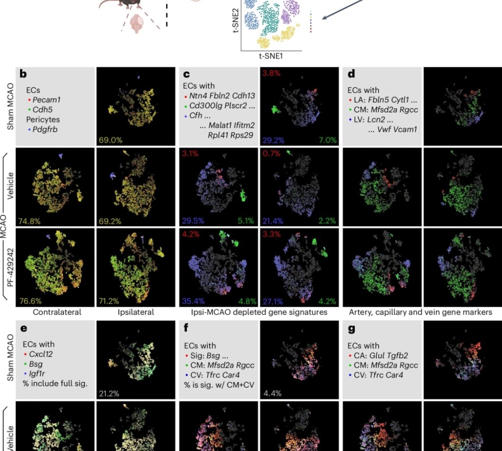 Inhibition of convertase SKI-1 prevents blood vessel alteration after stroke