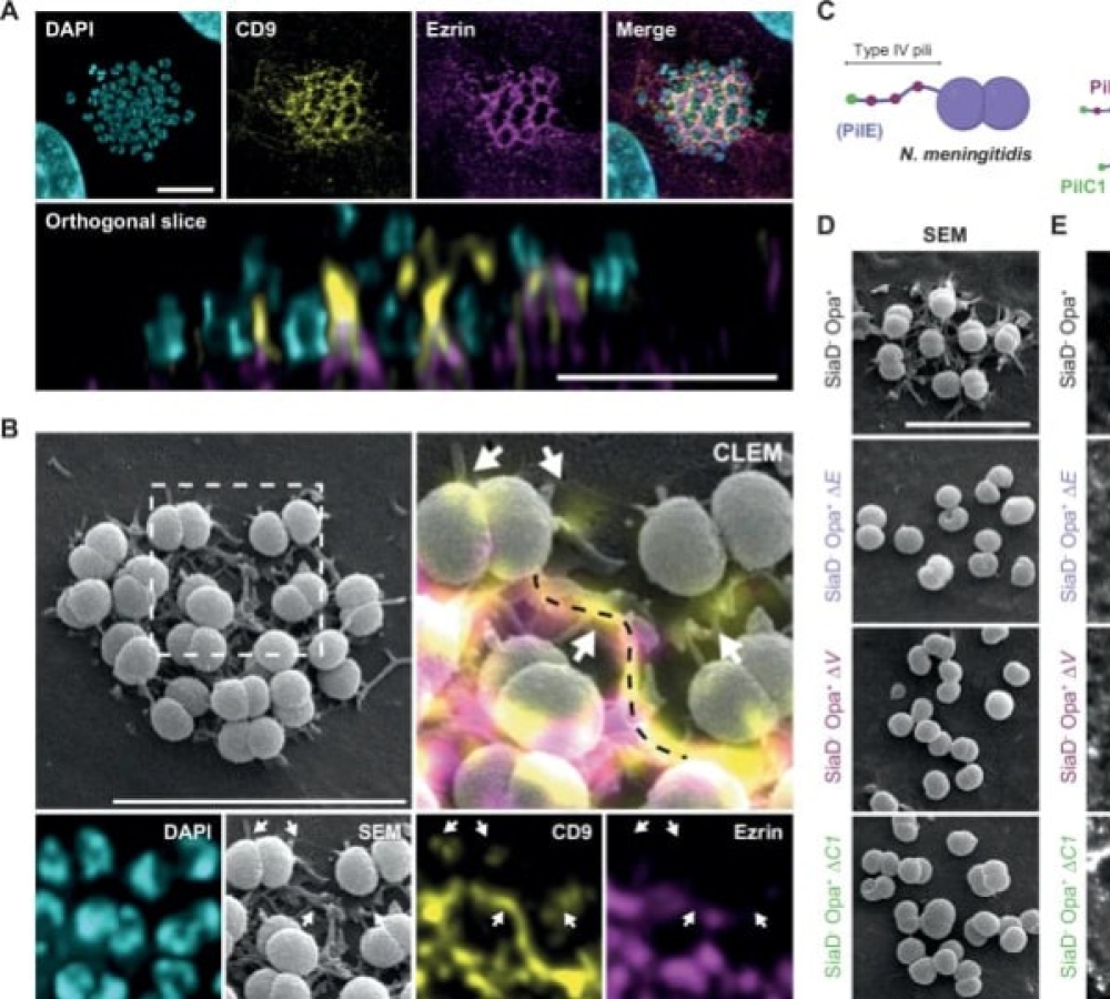 Meningococci drive host membrane tubulation to recruit their signaling receptors