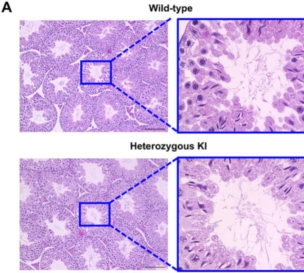 Longitudinal Analysis of Male Fertility Using an Acr-Luc Knock-In Mouse Model