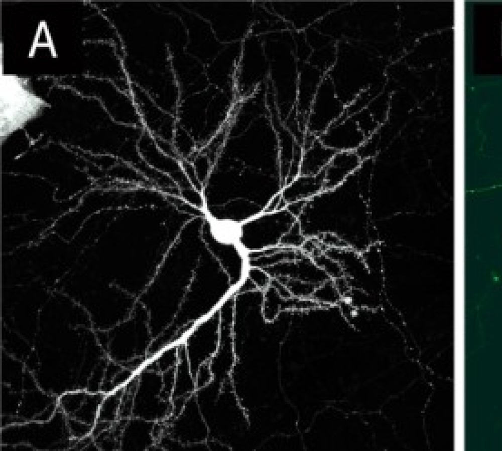 Magnetofection-Mediated Gene Delivery in Mature Primary Neurons