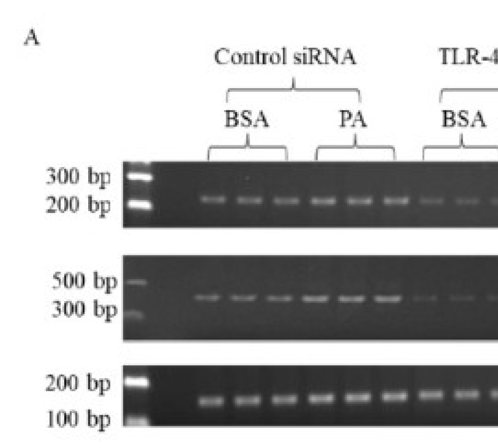Role of Cell Surface Receptors in Palmitic Acid-Induced IL-1β in Microglia Cells