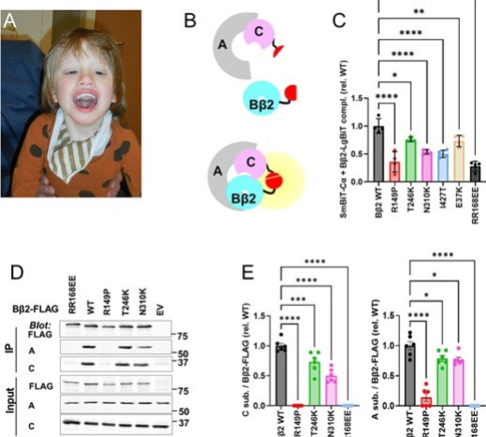 New insights into PPP2R2B variants in neurodevelopmental syndrome